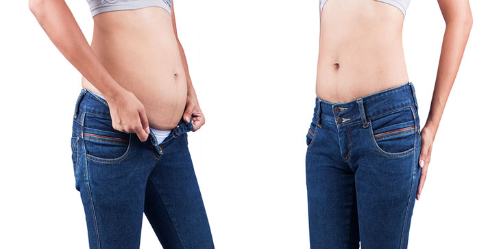 How to lose weight after a cesarean