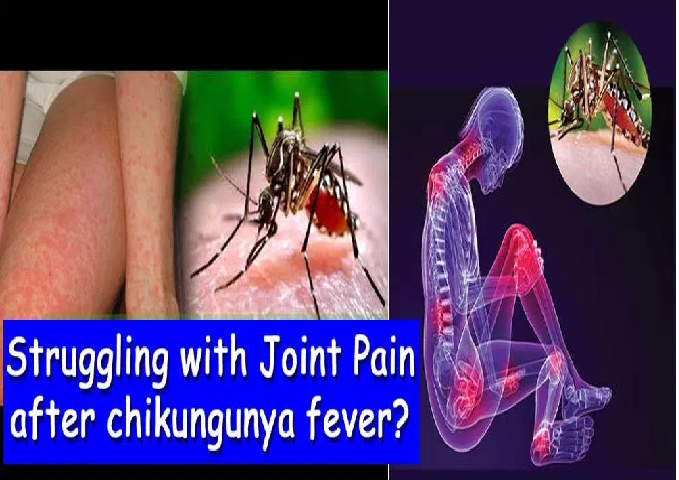 Listless, feverish and in pain? It could be chikungunya