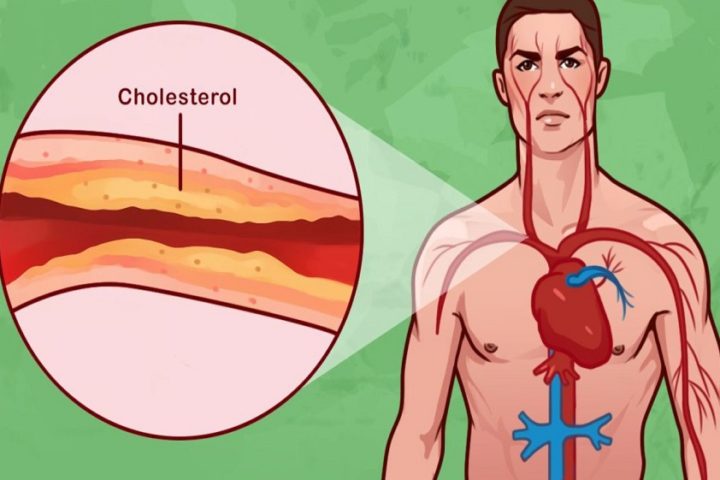Cholesterol In The Human Body