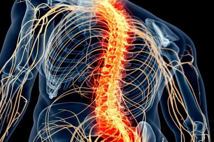 Spinal Cord Stimulation