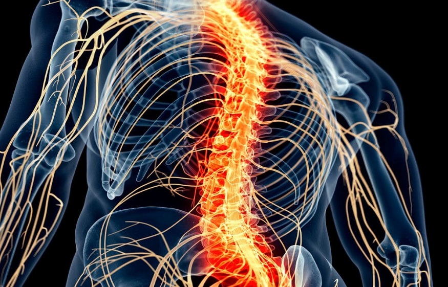 Spinal Cord Stimulation