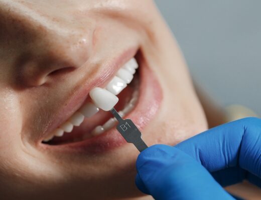 Porcelain Veneers a Worthy Option