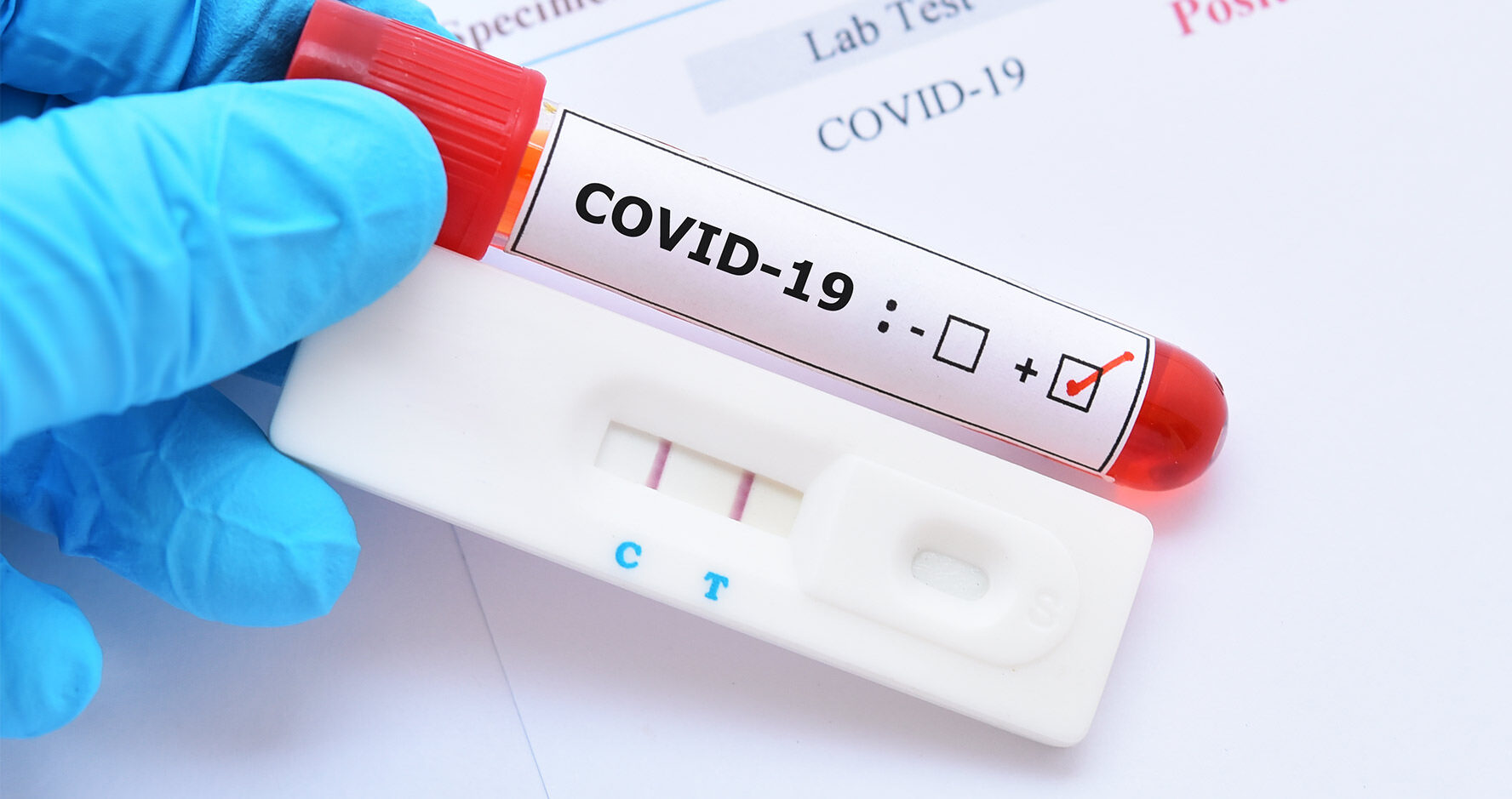 Covid Test