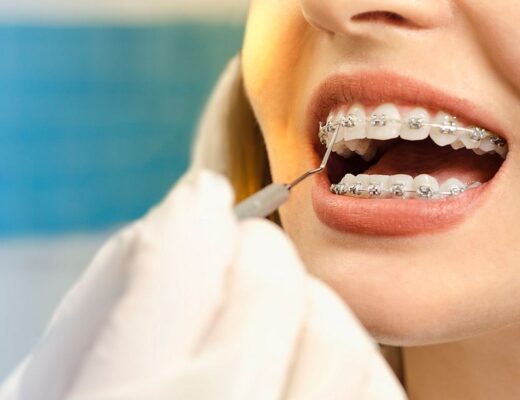 Orthodontic Care