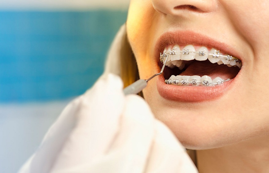 Orthodontic Care