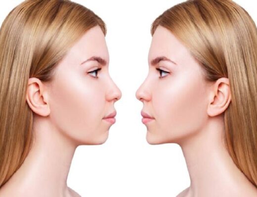 surgery on the jaw,