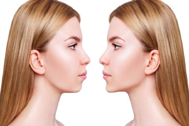 surgery on the jaw,