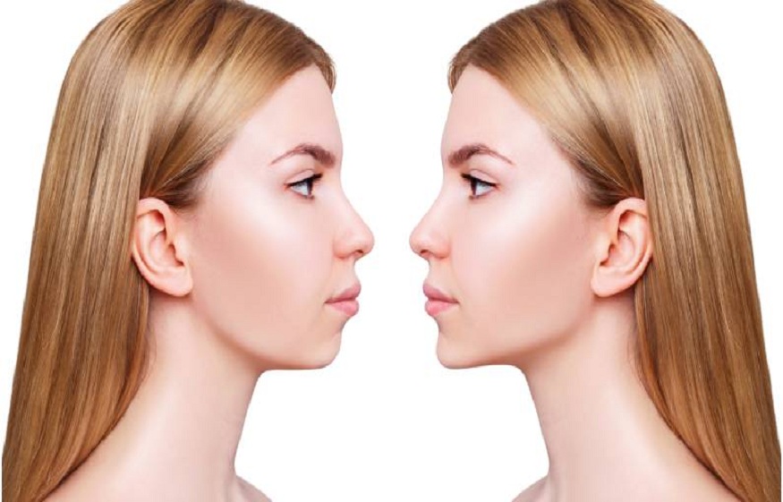 surgery on the jaw,