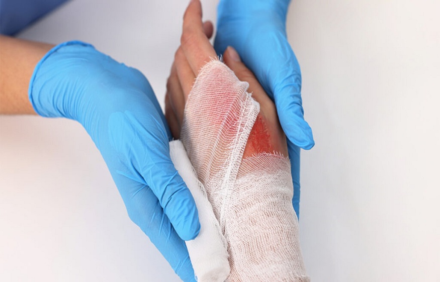 Good wound care