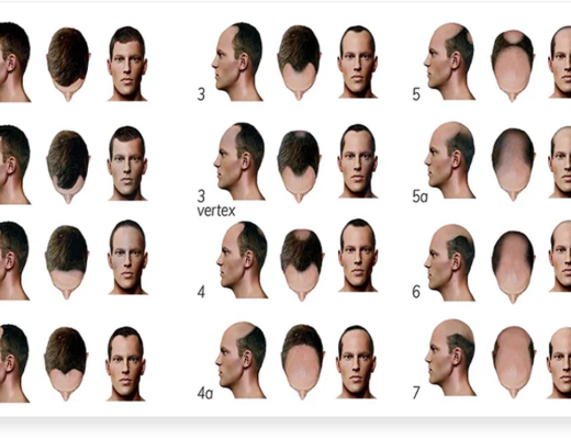 male hair loss treatment
